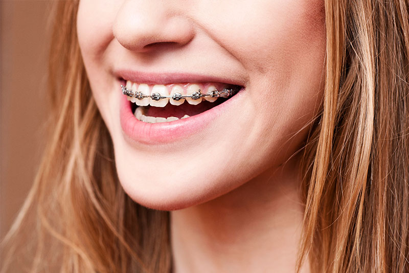 Orthodontics in Scottsdale